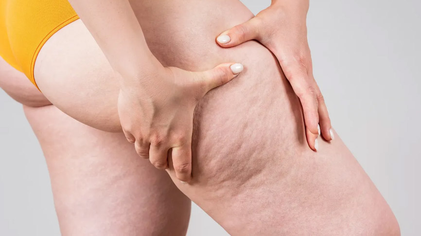lipodem nedir