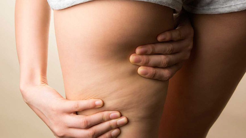 lipodem nedir